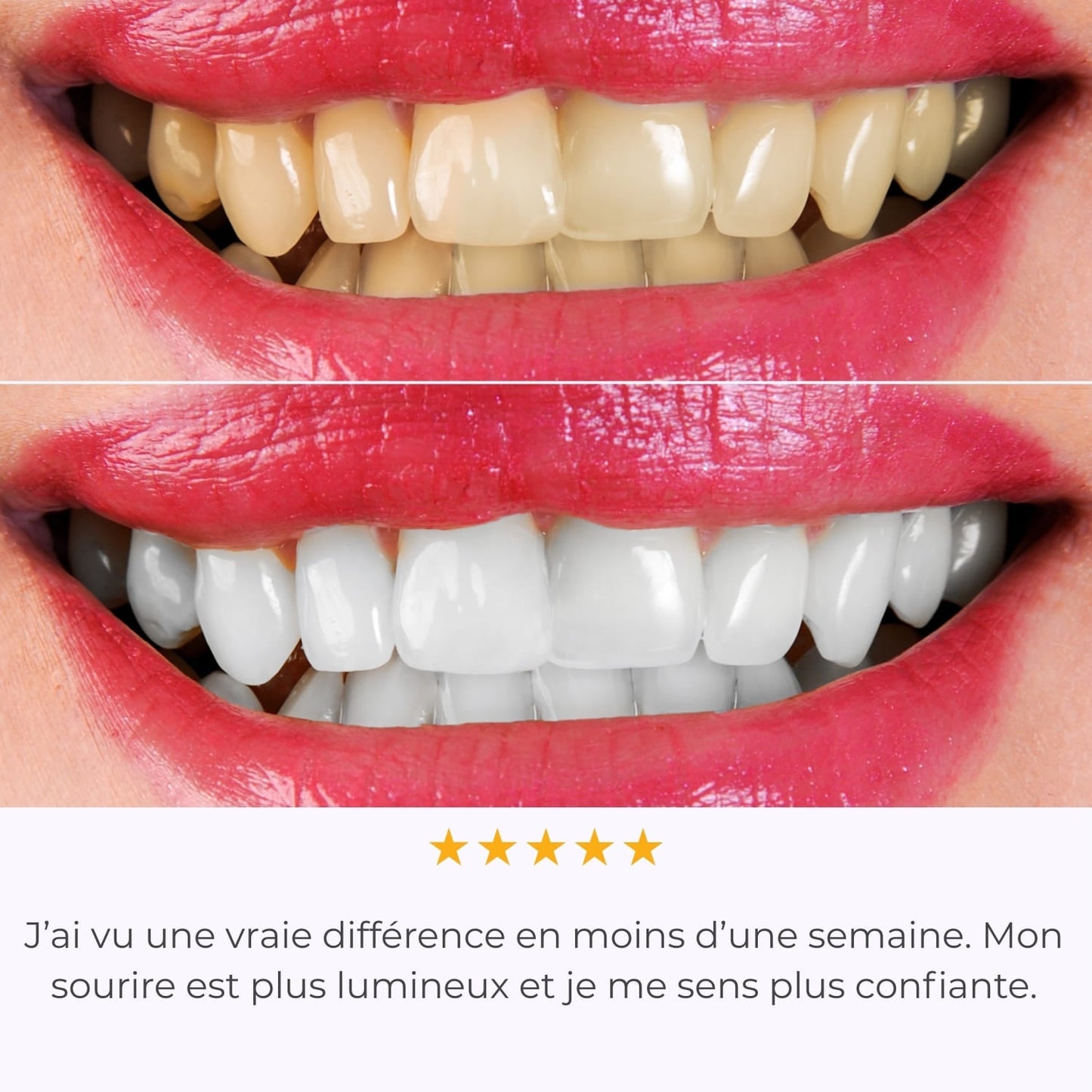 IVISMILE – Brosse à dents LED pour un sourire lumineux sans effort