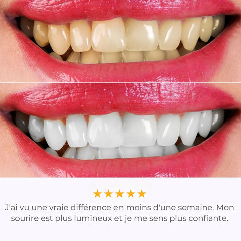 IVISMILE – Brosse à dents LED