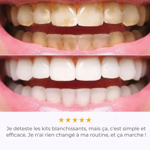 IVISMILE – Brosse à dents LED