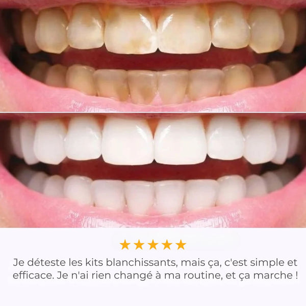 IVISMILE – Brosse à dents LED